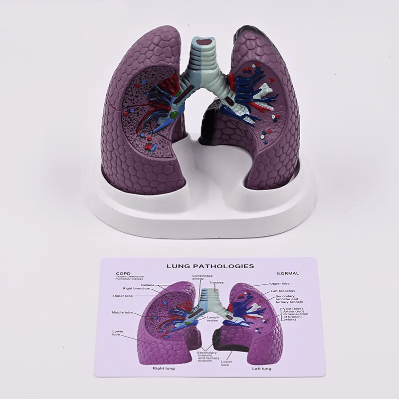 Lung Set Model with Pathologies – Dr Wong Anatomy