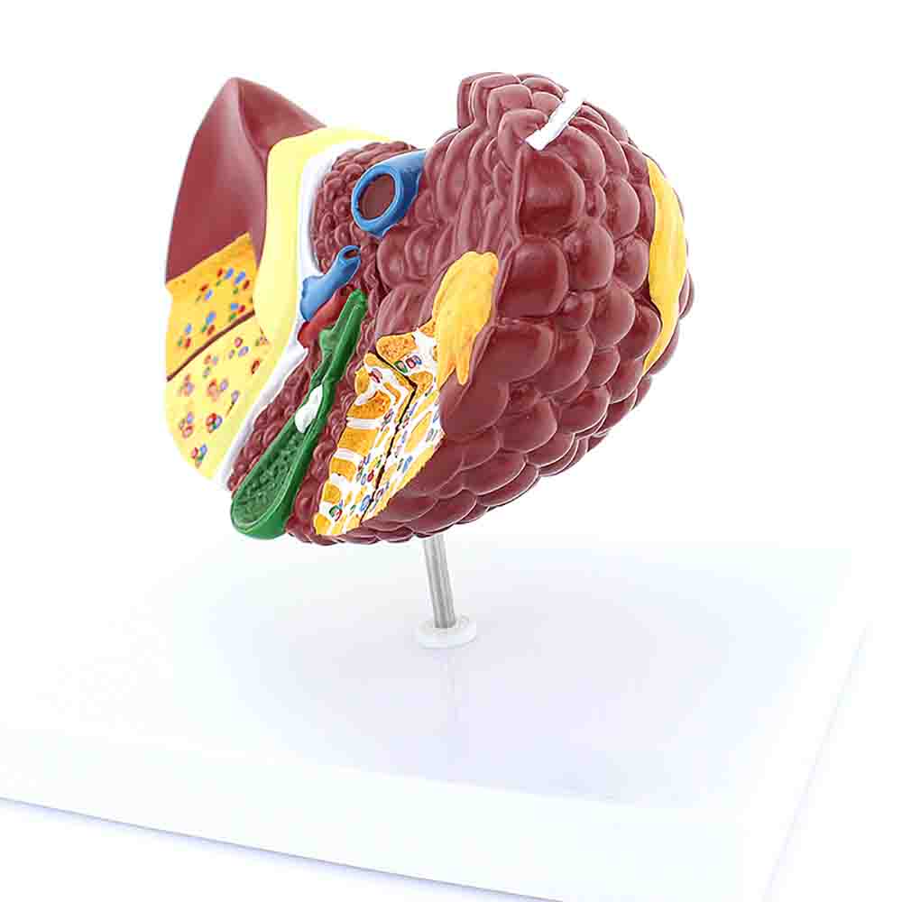 Liver With Pathologies Model