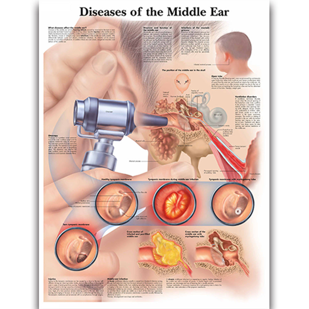 Diseases of the Middle Ear Chart - Dr Wong Anatomy
