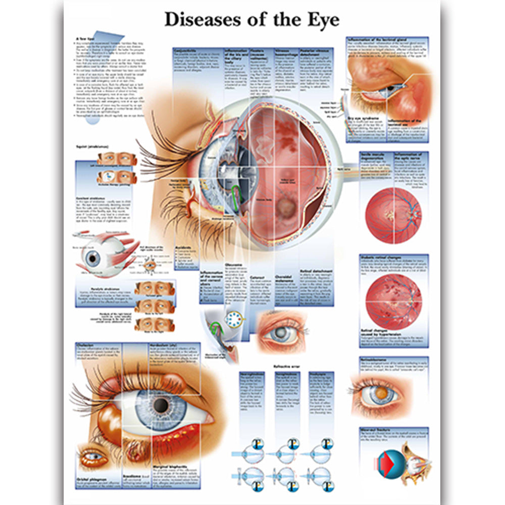 Diseases of the Eye Chart - Dr Wong Anatomy