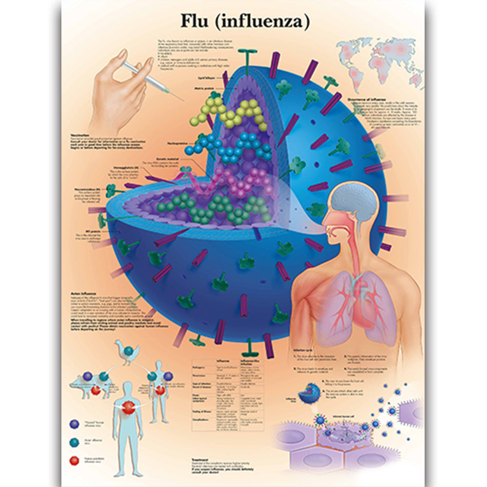 Flu (influenza) disease chart - Dr Wong Anatomy