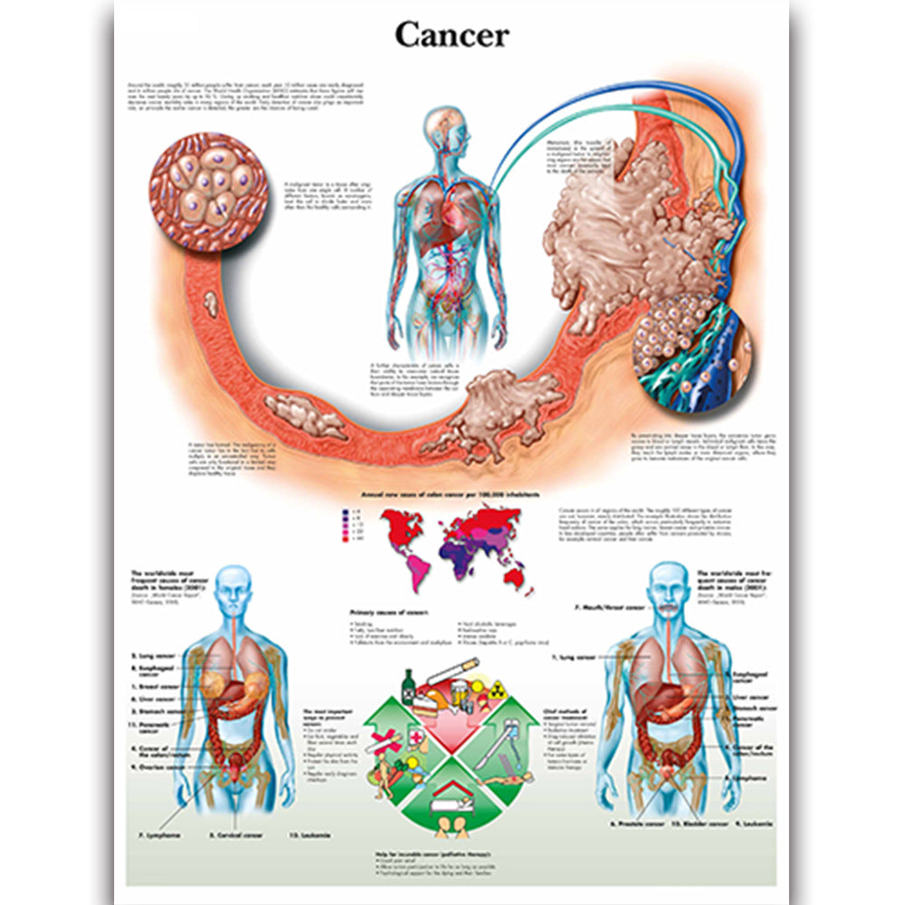 Cancer Disease Chart - Dr Wong Anatomy