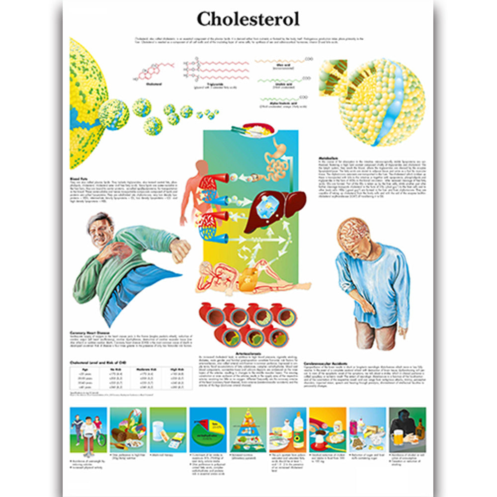 Cholesterol Chart- Dr Wong Anatomy