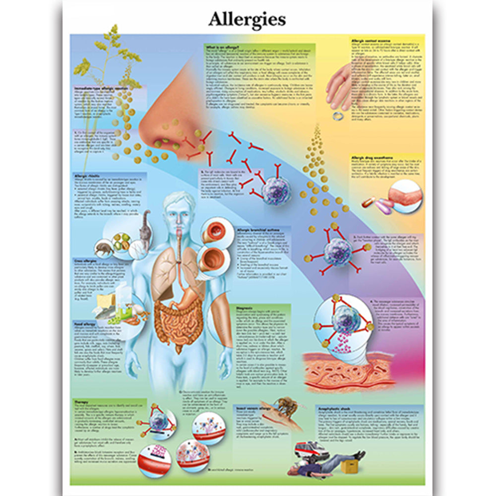  Allergies Chart - Dr Wong Anatomy