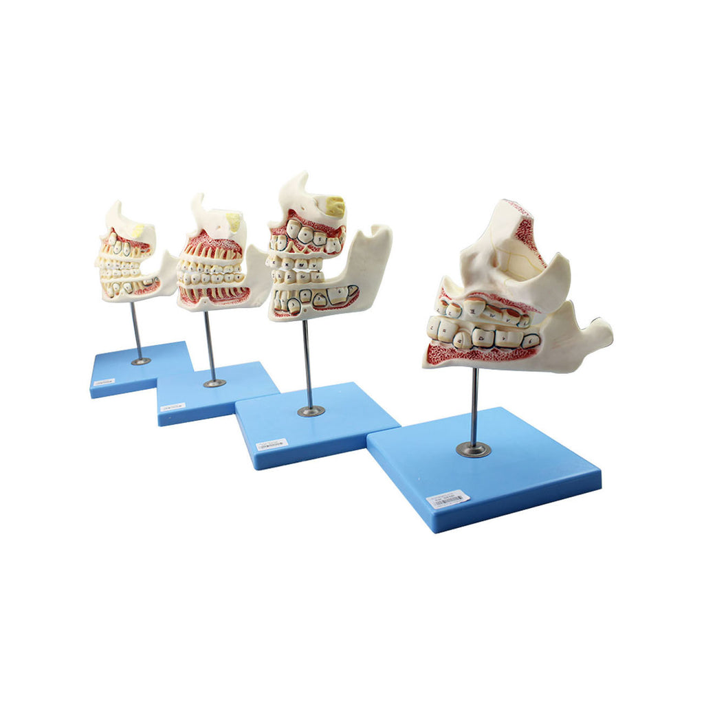 Dentition Development Model - Dr Wong Anatomy