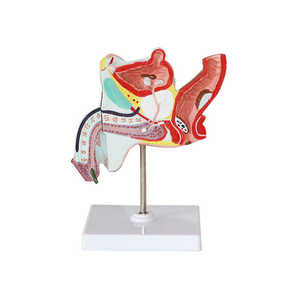 Pathological Male Urogenital System, Life-Size - Dr Wong Anatomy