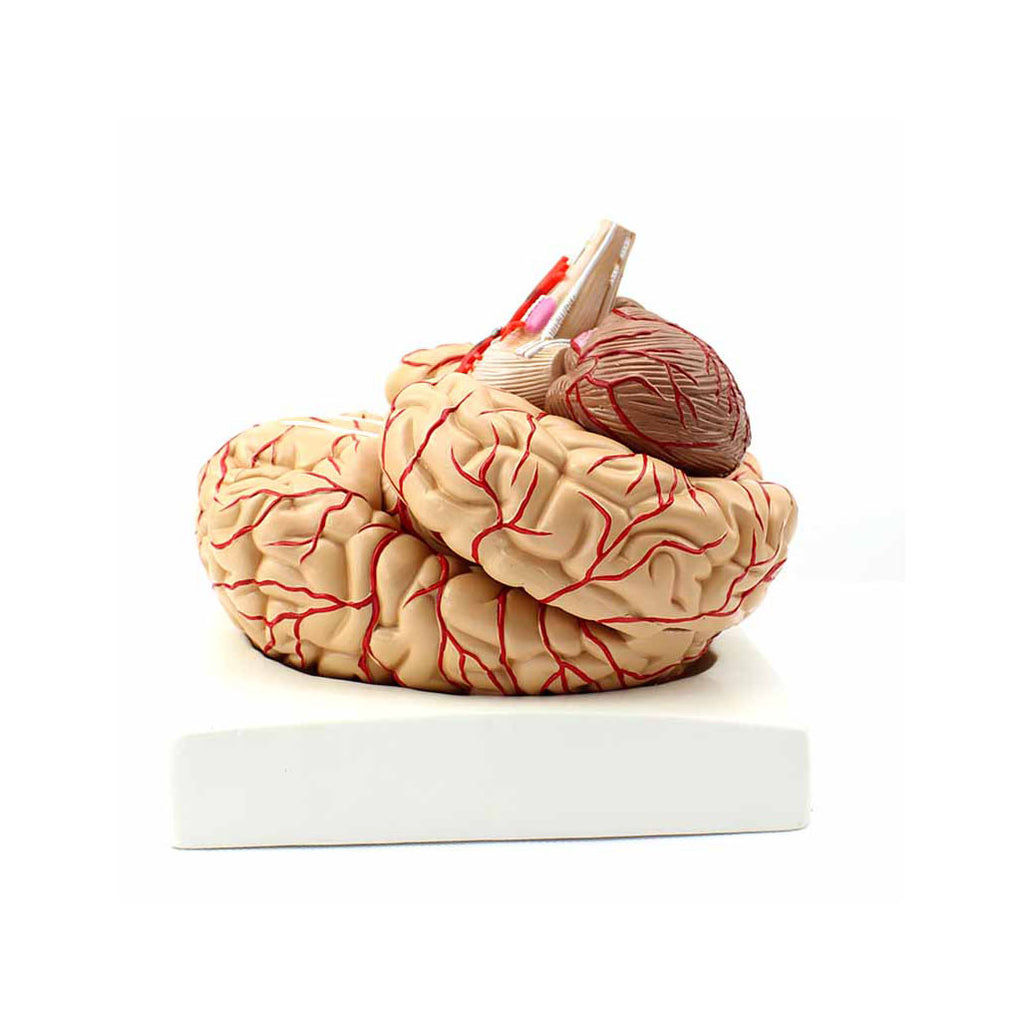 Brain with Arteries Model, 9 Parts - Dr Wong Anatomy