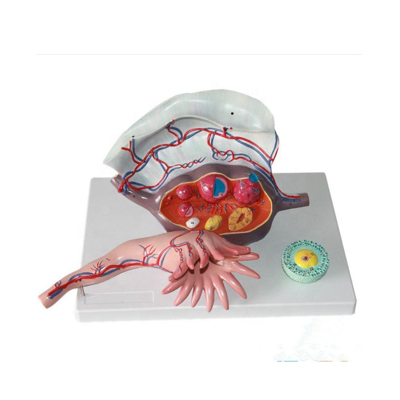 Human Ovary Model, 5X Life-Size - Dr Wong Anatomy