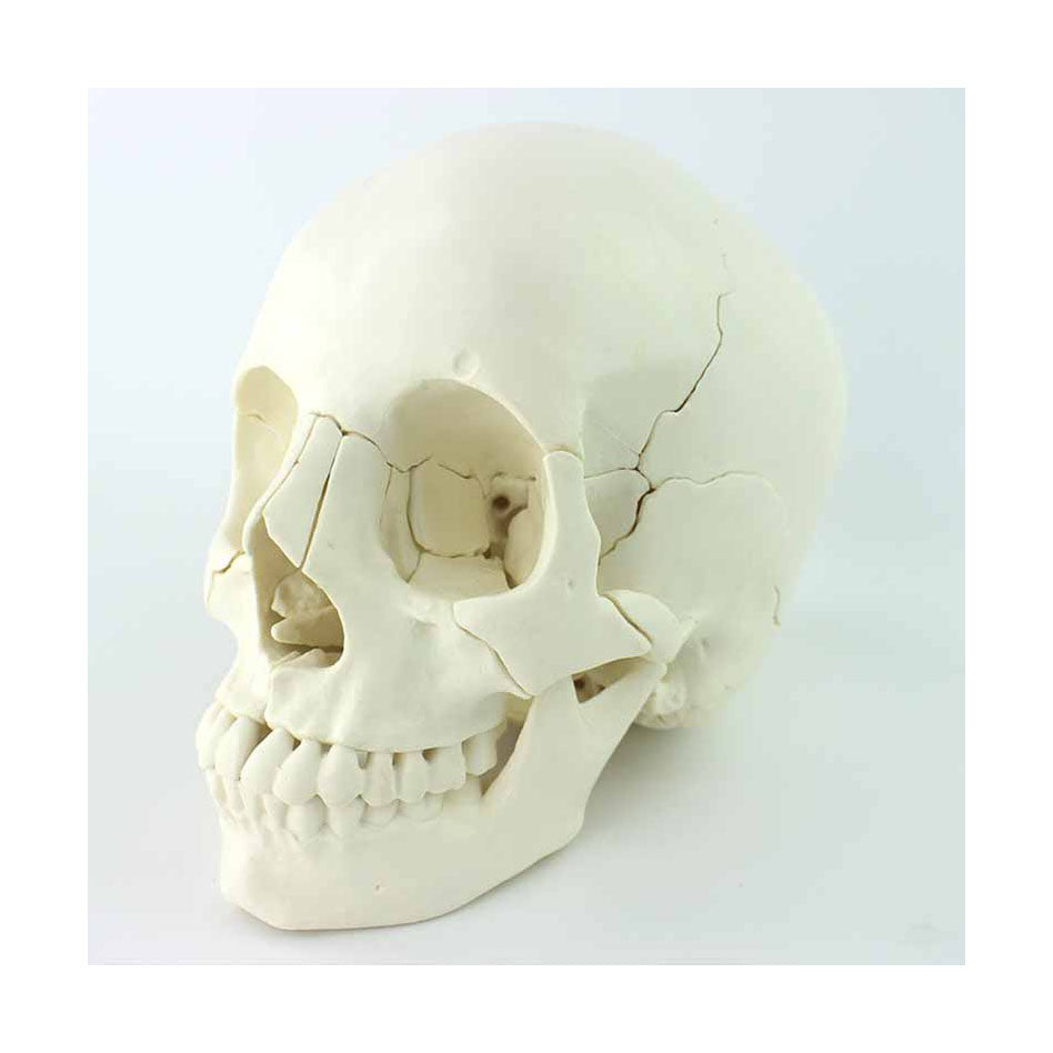  Skull Model, Life-Size, 22 Parts - Dr Wong Anatomy