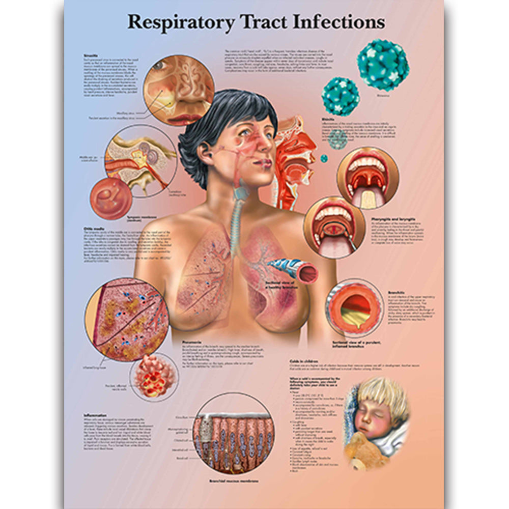  Respiratory Tract Infections Chart - Dr Wong Anatomy