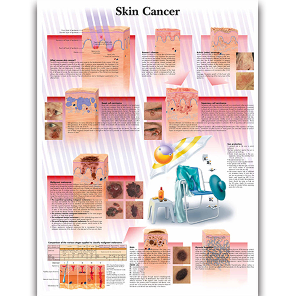 Skin Cancer Chart - Dr Wong Anatomy