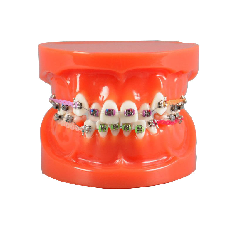 Dental Orthodontic Model with Metal Bracket and Elastic