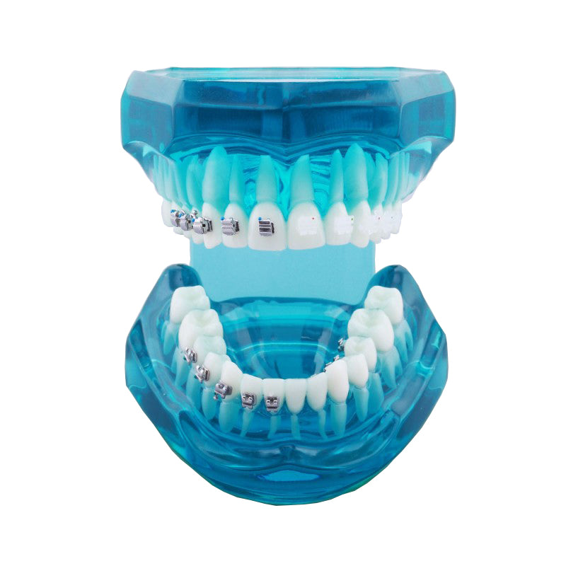 Dental Orthodontic Model with Self-Ligating Bracket