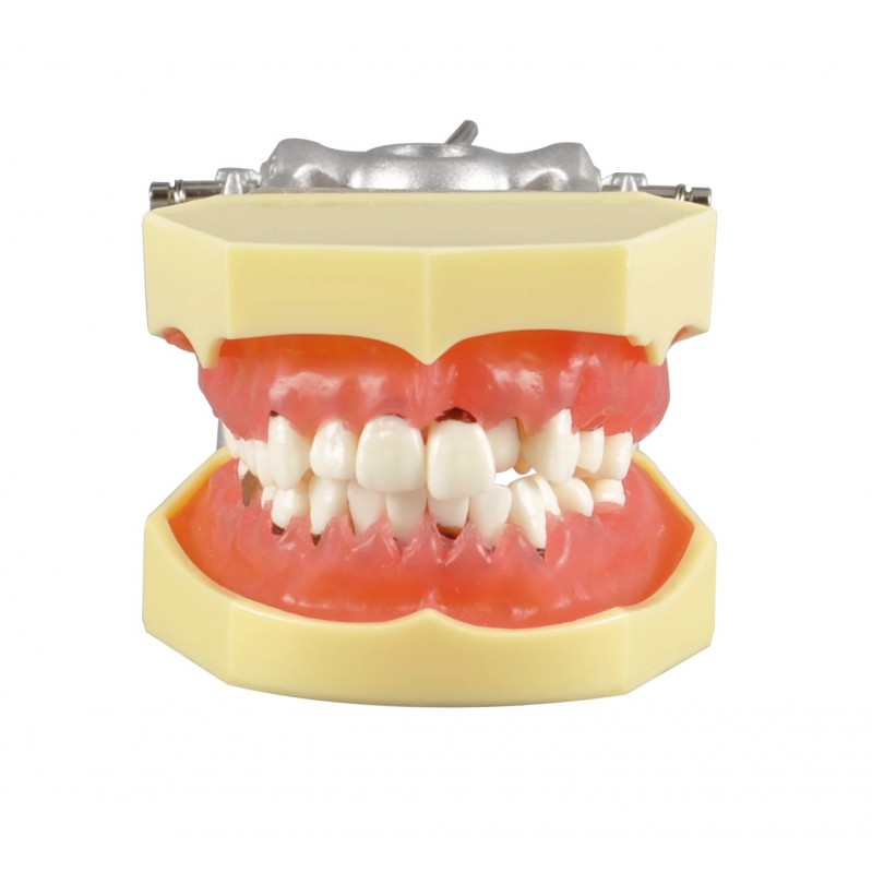 Dental Periodontal Model with Different Symptom