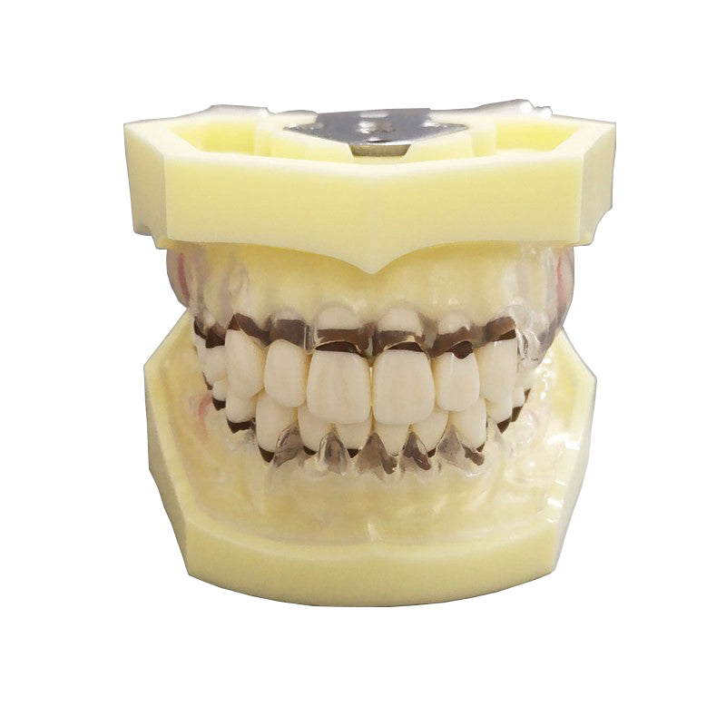 Dental Periodontal Model with Transparent Gum