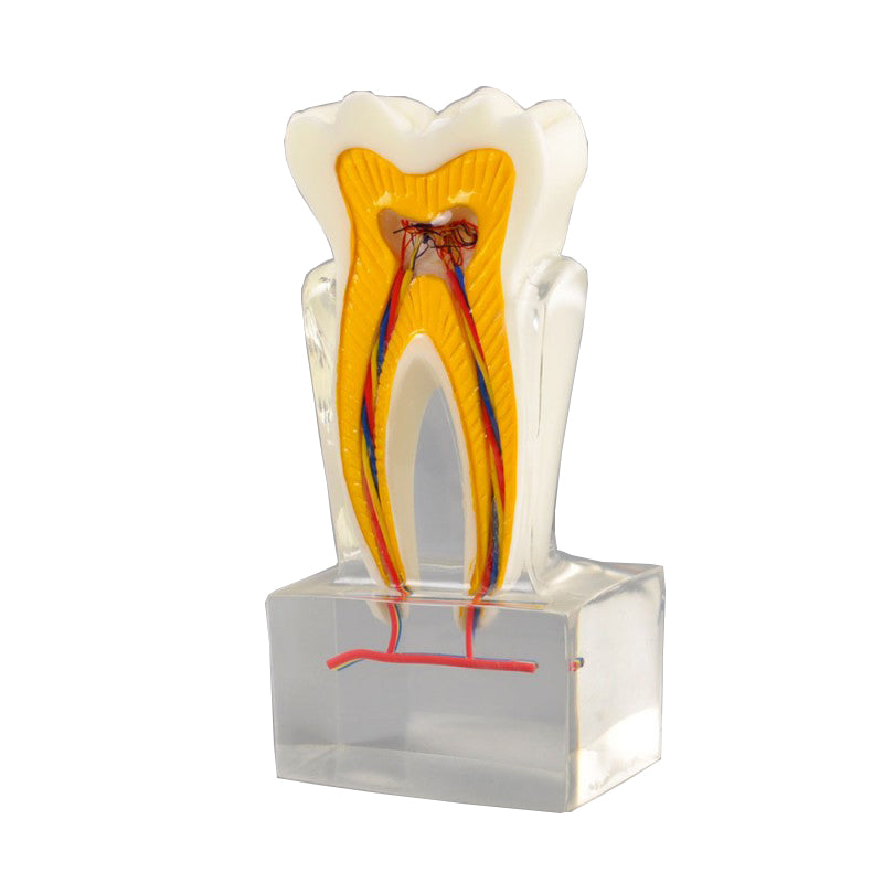  Tooth Model, 6X Life-Size