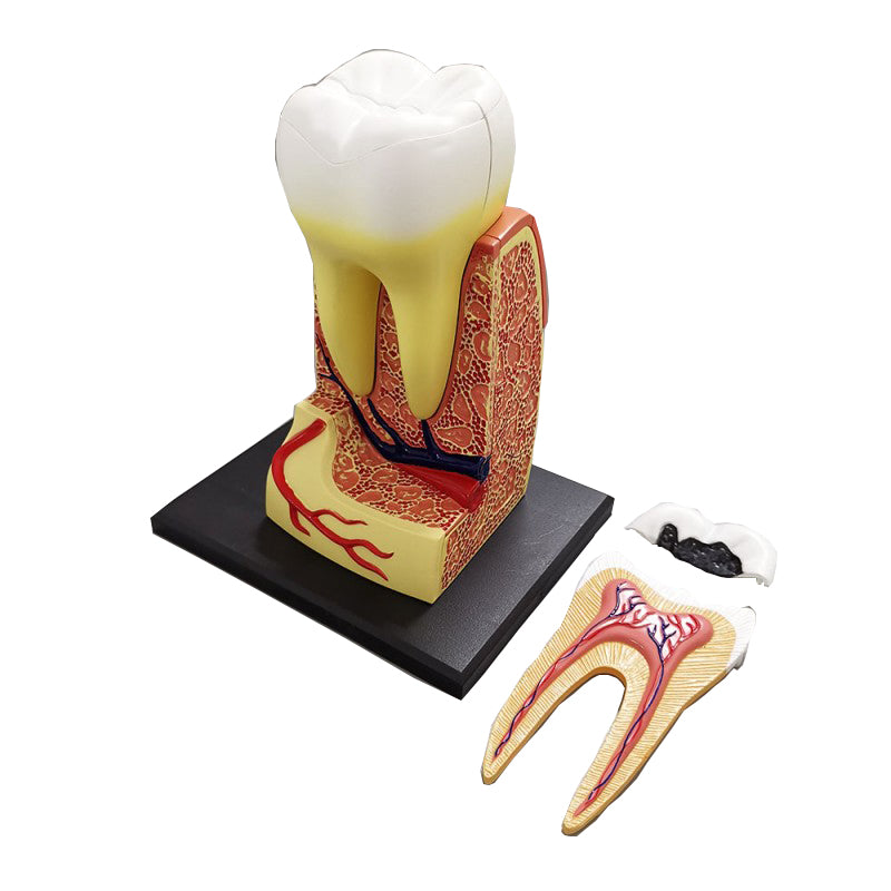 3D Removable Molar Model with Nerve