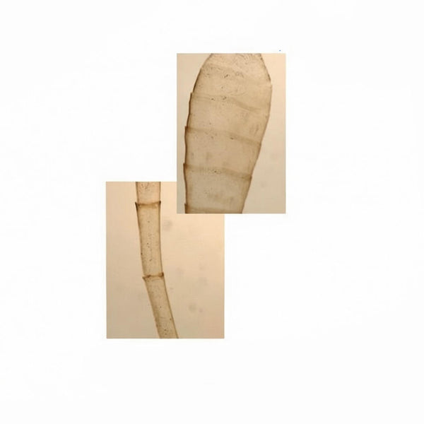 Clubbed Antenna (Club-shaped Antenna), Microscope Slide - Dr Wong Anatomy