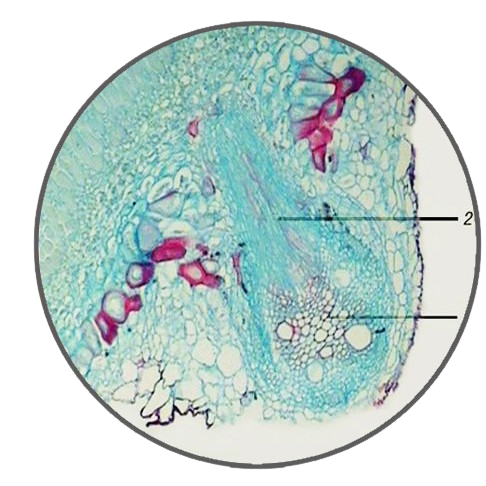 Soybean Root Nodule, Prepared Microscope Slide - Dr Wong Anatomy