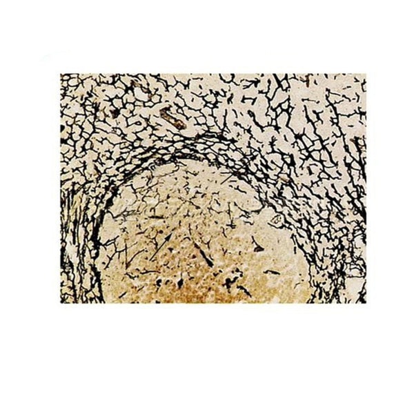 Lymph Node Reticular Tissue, Silver-Impregnated, Microscope Slide - Dr Wong Anatomy