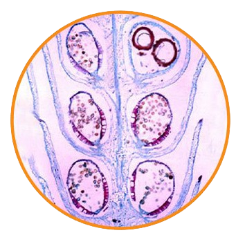 Chinese Clubmoss Strobilus, l.s. Prepared Microscope Slide