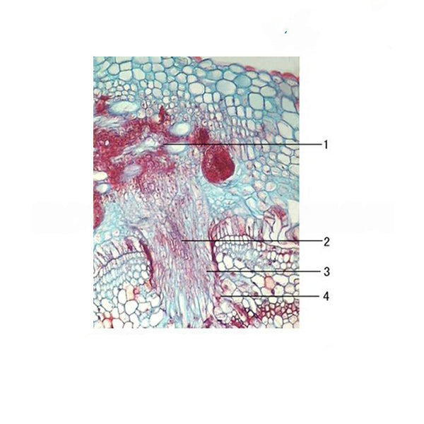 Cuscuta (Dodder) Haustorium on Host, Prepared Microscope Slide - Dr Wong Anatomy