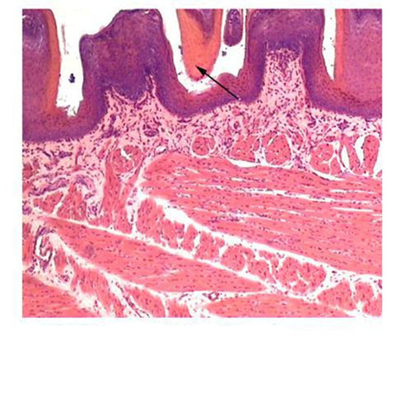 Cat Tongue (Stratum Corneum), l.s. Microscope Slide - Dr Wong Anatomy
