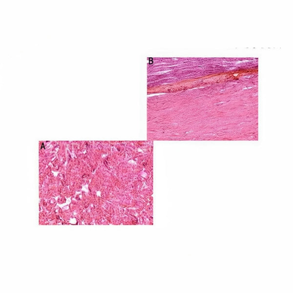 Nerve Trunk, c.s. & l.s. Microscope Slide - Dr Wong Anatomy