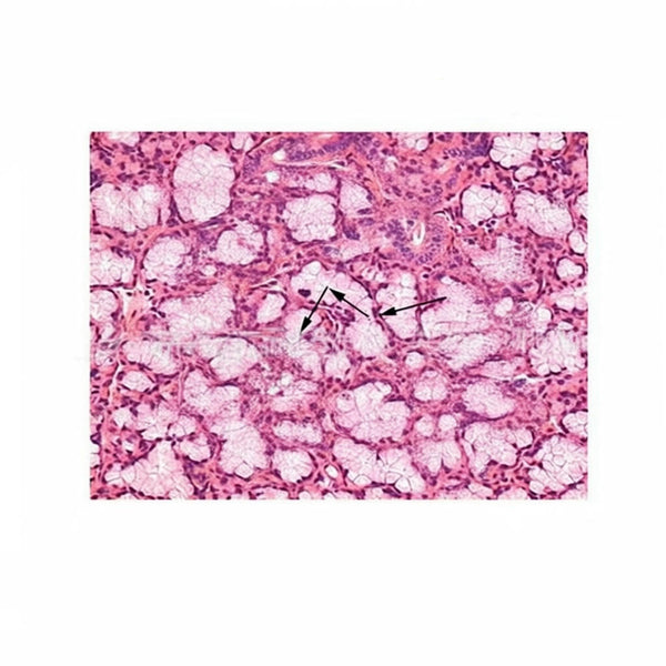 Parotid Gland, Microscope Slide - Dr Wong Anatomy