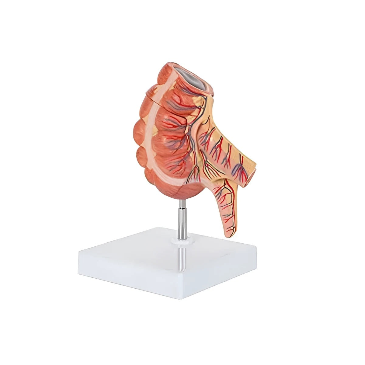 Appendix Model Kit Caecum and Appendix Model, 1.5X Life-Size – Dr Wong Anatomy