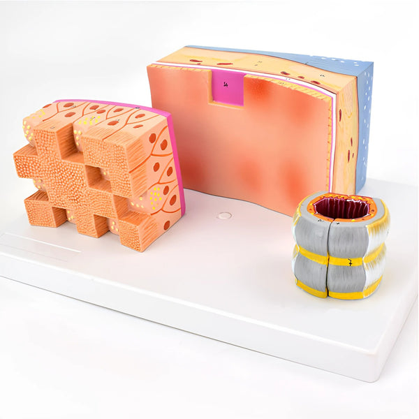 Tracheal Wall Enlarge Model