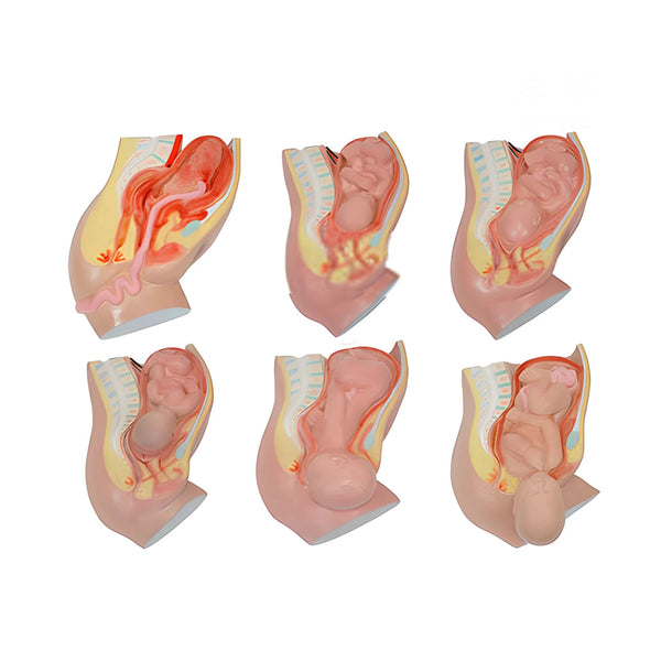 Fetal Delivery Process Model