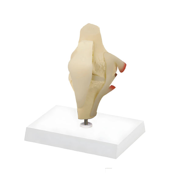 Basic Knee Model