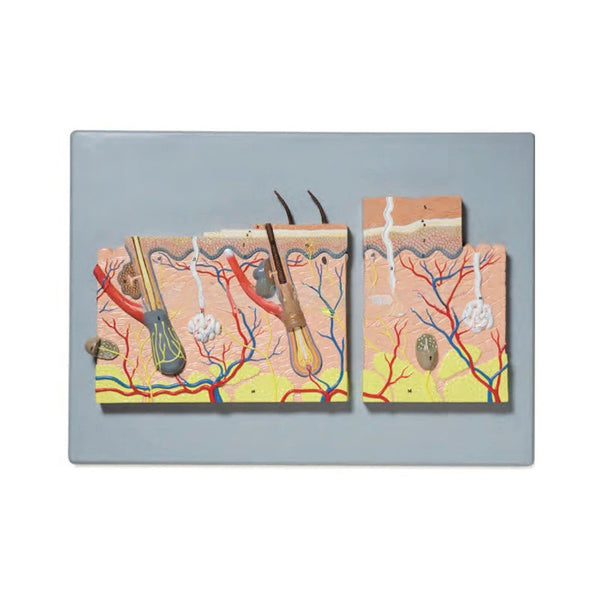 Enlarged Model of Skin with and without Hair Follicles, 70X Life-Size