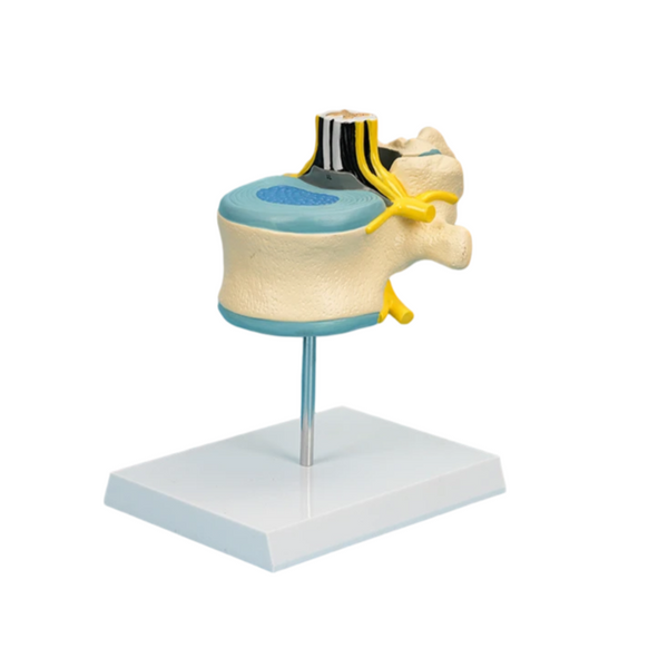 Lumbar Vertebra (L II) with Lumbar Region of Spinal Cord Model