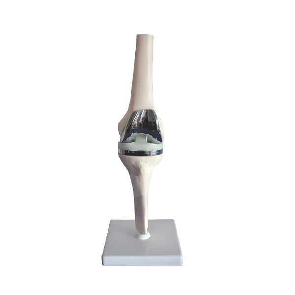 Knee Model With Endoprosthesis