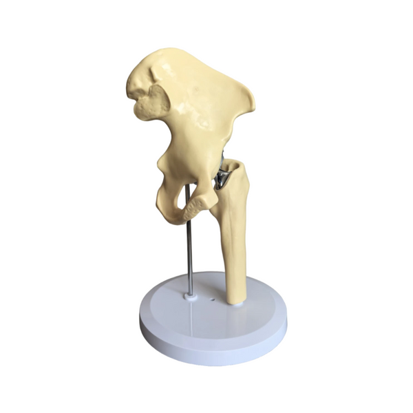 Hip Joint Model With Endoprosthesis