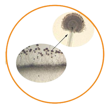 Aspergillus, Prepared Microscope Slide