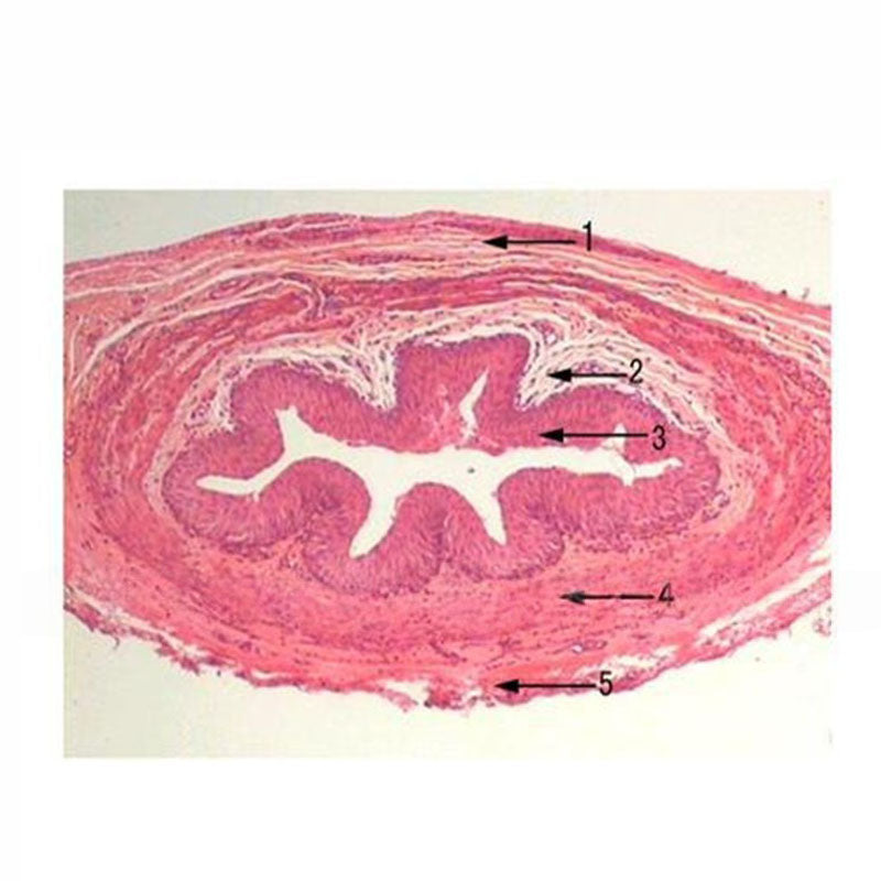 Ureter, c.s. Microscope Slide - Dr Wong Anatomy