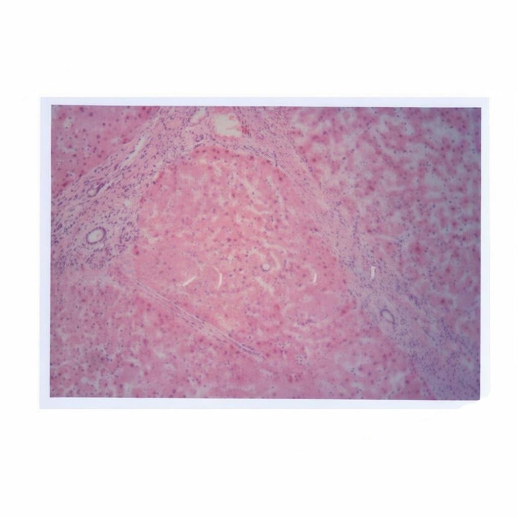 Liver Cirrhosis, Microscope Slide - Dr Wong Anatomy