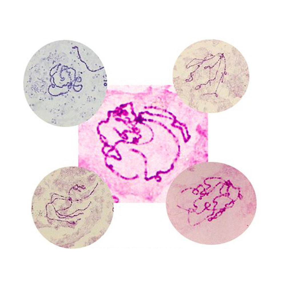Fruit Fly Salivary Gland Chromosome, Microscope Slide - Dr Wong Anatomy