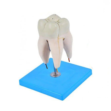 Upper Triple-Root Molar Human Tooth Model, 3 part
