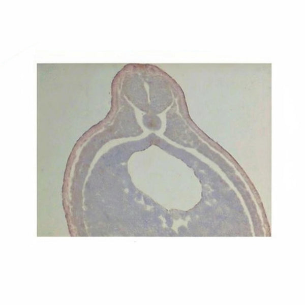 Frog Neural Tube Stage, Microscope Slide - Dr Wong Anatomy