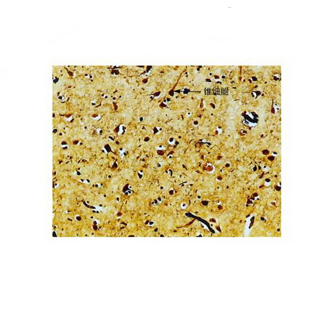 Pyramidal Cells Microscope Pyramidal Cells of Cerebral Cortex, Prepared Microscope Slide – Dr Wong ...