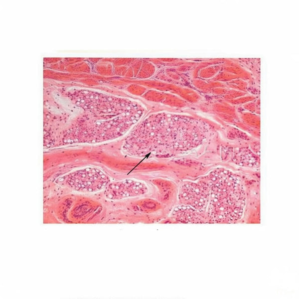 Adipose Tissue, Microscope Slide - Dr Wong Anatomy