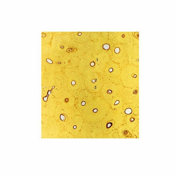 Decalcified Compact Bone, c.s. Microscope Slide - Dr Wong Anatomy