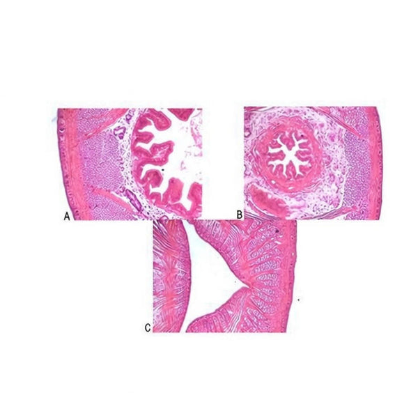 Hirudinea (Leech) Three Regions (Anterior, Middle, Posterior), c.s. Prepared Microscope Slide