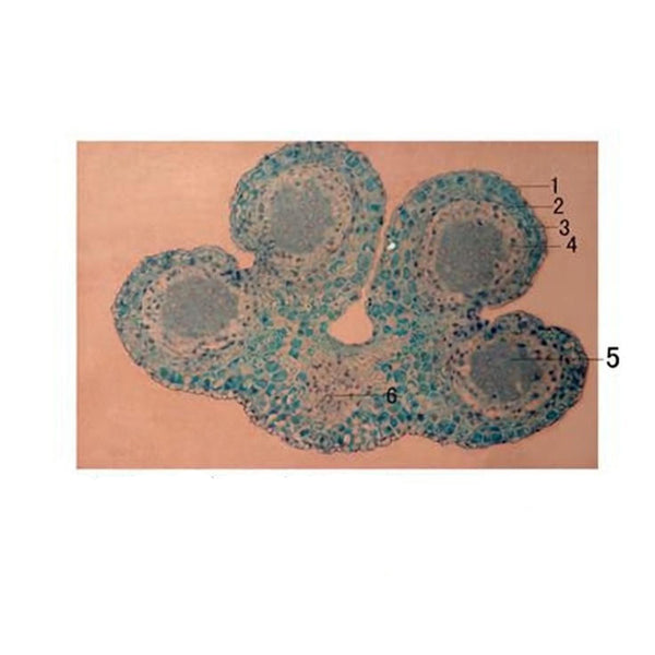 Lily Anther, Immature, c.s. Prepared Microscope Slide - Dr Wong Anatomy