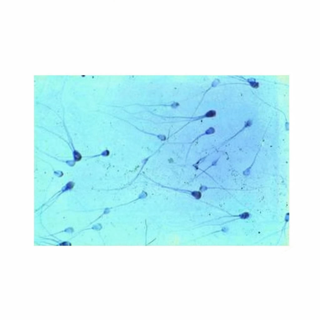 Sperm Smear, Microscope Slide - Dr Wong Anatomy