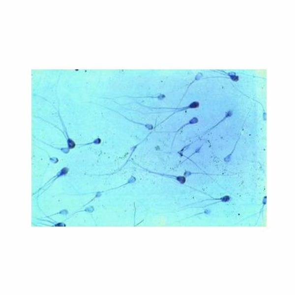 Sperm Smear, Microscope Slide - Dr Wong Anatomy